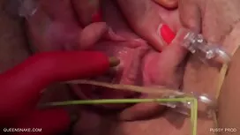 تجميع زوجين شابين أم ...